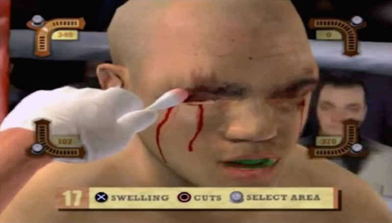 Illustration for article titled A Pro Fighter's Best Friend Is The Guy Who Stops The Bleeding